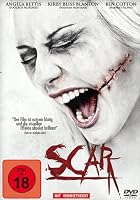 Scar