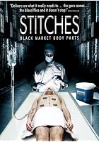 Stitches