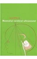 Neonatal Cerebral Ultrasound, by Janet M. Rennie