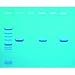 Detection of Mad Cow Disease