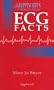 Lippincott's Need-to-Know ECG Facts
