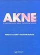 Akne