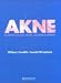Akne (German Edition)
