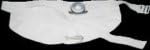Non-Adh Uro System, Xs Pch, Sm Ring,Right Stoma