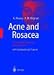 Acne and Rosacea