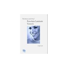 The Science and Art of Porcelain Laminate Veneers