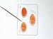 SciEd Understanding the Genetics of Blood Groups