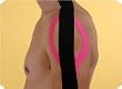 Kinesio&reg; Tex Taping Kit Includes 2 Rolls Water Resistant Kinesio Tape and skin prep wipes.
