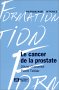 Cancer de la prostate