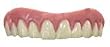 Billy Bob Teeth Secure Smile - Size Medium To Large