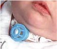 Tilson Trach Guard
