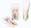 11TnJa7w8HL Educational Insights   Teeth Model