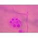 Preparation Of HeLa Cell Chromosomal Spreads