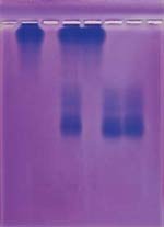 Screening Hemoglobin for Sickle Cell Lab Activity