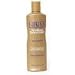 alopecia12  - Nisim Shampoo for Hair Loss Normal to Oily