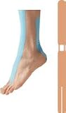 Spidertech Ankle, Beige Engineered to Optimize Protocol for Patient Treatment Without the Complexity and Inconsistency of Manual Taping