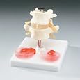 226 - Lumbar Vertebrae with Interchangeable Discs
