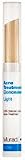 Murad Acne Treatment Concealer - Light (0.09 oz)