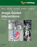 Image-Guided Intervention, 2-Volume Set: Expert Radiology Series