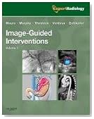 Image-Guided Interventions: Expert Radiology Series, 1e
