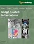 Image-Guided Intervention, 2-Volume Set: Expert Radiology Series