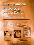 Interventional Radiology of the Spine: Image-Guided Pain Therapy