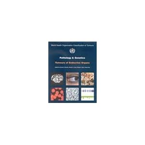 Click here to buy Pathology and Genetics of Tumours of Endocrine Organs (IARC WHO Classification of... by The International Agency for Research on Cancer.
