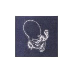 Agaetis Byrjun