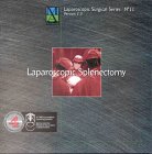 Laparoscopic Splenectomy: Laparoscopic Surgical Series