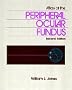 Atlas of the Peripheral Ocular Fundus, 2e