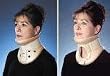 Philadelphia Collar With Trach Hole Medium 13-16, 4-1/4 H
