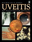Produkt-Bild: Uveitis: An Illustrated Manual: pa