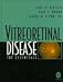 Vitreoretinal Disease: The Essentials