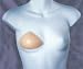  : Amoena Balance Part- Top
