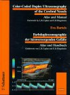 Farbduplexsonographie der hirnversorgenden Gefäße. Atlas und Handbuch: Atlas and Manual. Atlas und Handbuch. Eurobook-Bilingial (Bilingual/Eurobooks)