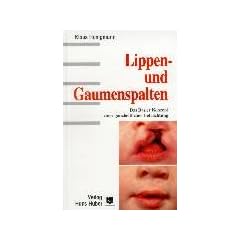 Lippen- und Gaumenspalten: Das Basler Konzept einer ganzheitlichen Betrachtung