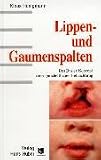 Lippen- und Gaumenspalten: Das Basler Konzept einer ganzheitlichen Betrachtung