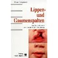 Lippen- und Gaumenspalten: Das Basler Konzept einer ganzheitlichen Betrachtung