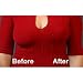  Lift Saggy Breasts Instantly! Bring It Up Lifts are applied to the top of the breast, not underneath. They are an invisible, waterproof, hypoallergenic adhesive unlike any other breast lift ever seen before. These breast lifts will provide full support, without a bra, up to size D cup. For larger breasted women over a size D cup, they can be worn with a bra for added support. Great with swimsuits, backless and strapless fashions and are virtually undetectable. Keep out of reach of children. Store at room temperature. Avoid exposure to heat or sunlight. Watch Movie Contains 8 Pairs Lifts up to a "D" Cup Clear See-Through 