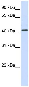 HSD3B2 Antibody, 50 ug