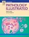 Pathology Illustrated