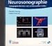 Neurosonographie, 1 CD-ROM Sonographie der intrakraniellen und extrakraniellen Gef&auml;&szlig;e. F&uuml;r Windows 95/98/NT 4.0