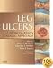 Leg Ulcers: A Problem-Based Learning Approach
