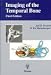 Imaging of the Temporal Bone