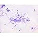 Gram Negative and Positive