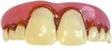 Fake Teeth | Billy Bob Tombstones Teeth