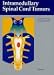 Intramedullary Spinal Cord Tumors