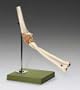 Functional Elbow Joint Model