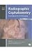 Radiographic Cephalometry: From Basics to 3-d Imaging