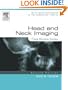Head & Neck Imaging: Case Review Series